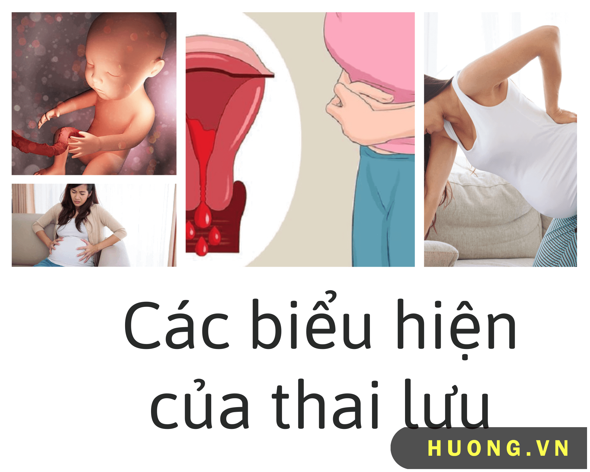 thai luu co bieu hien gi4 1