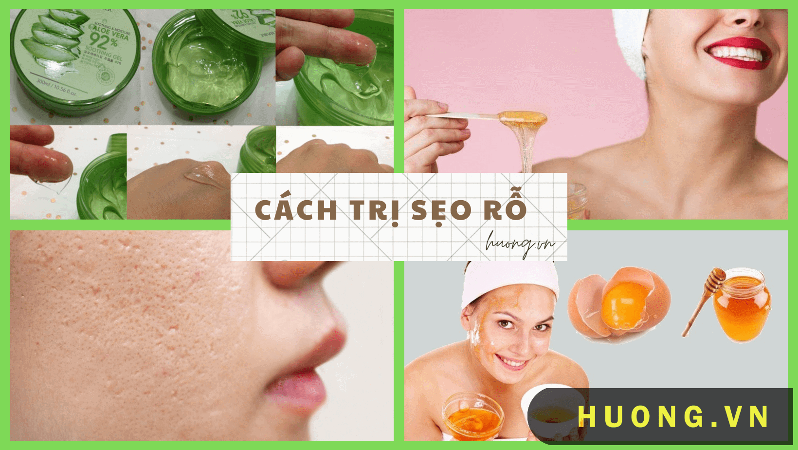 Cách trị sẹo rỗ trên mặt