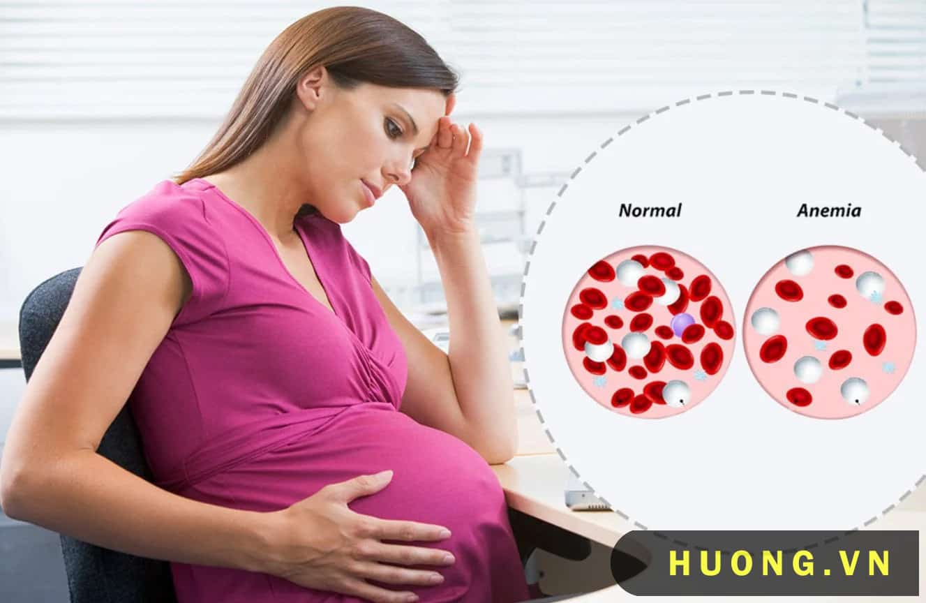 Tình trạng thiếu máu rất thường gặp ở các chị em mang thai