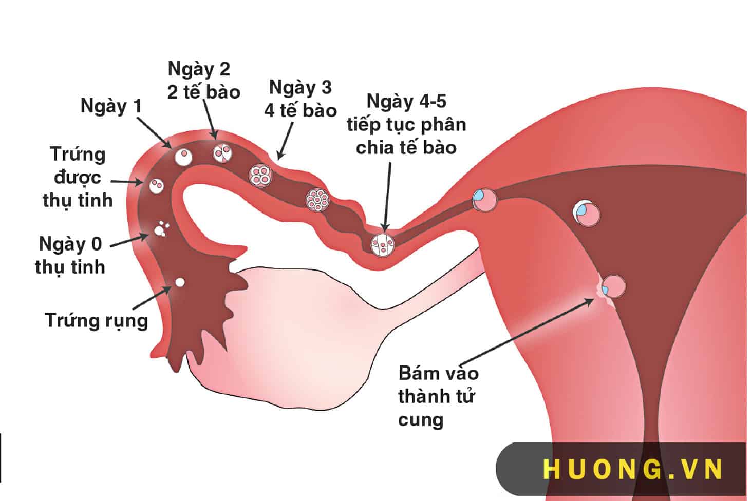 Hình ảnh mang thai ở tử cung