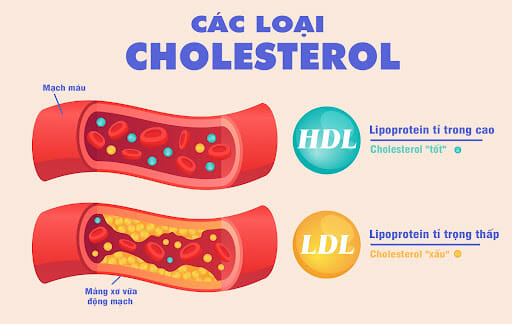 Cholesterol là gì? Các loạI cholesterol và công thức cấu tạo 