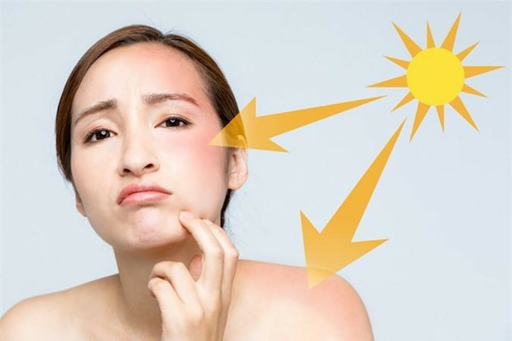 Dùng kem chống nắng sai cách biến 'cứu tinh' thành 'tội đồ' của da