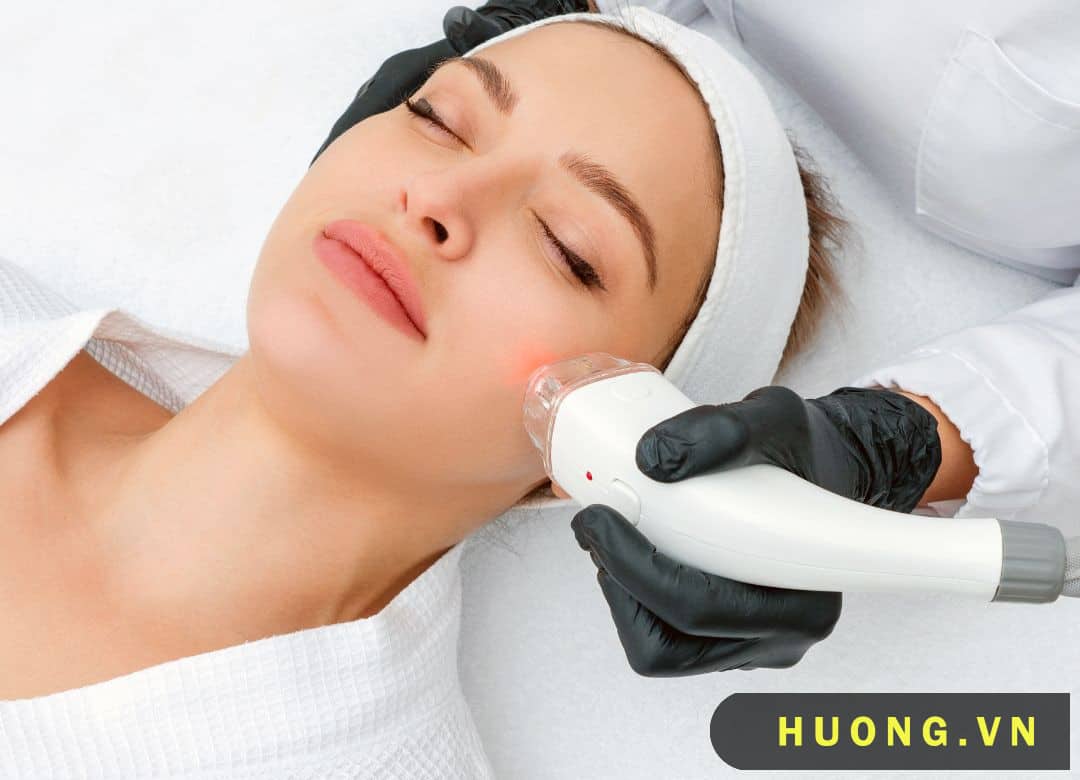 Trị mụn bằng tia laser