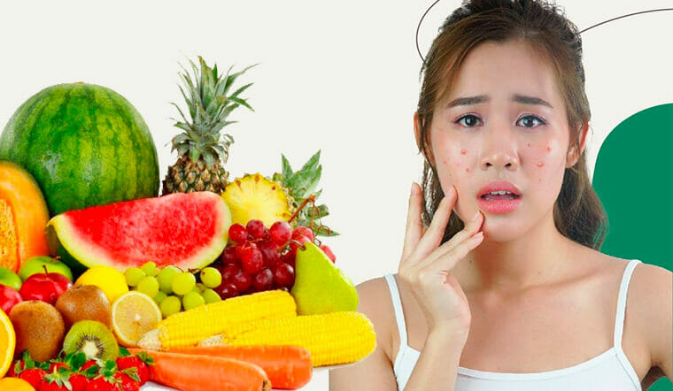 Những loại trái cây mà người bị mụn tuyệt đối không nên ăn