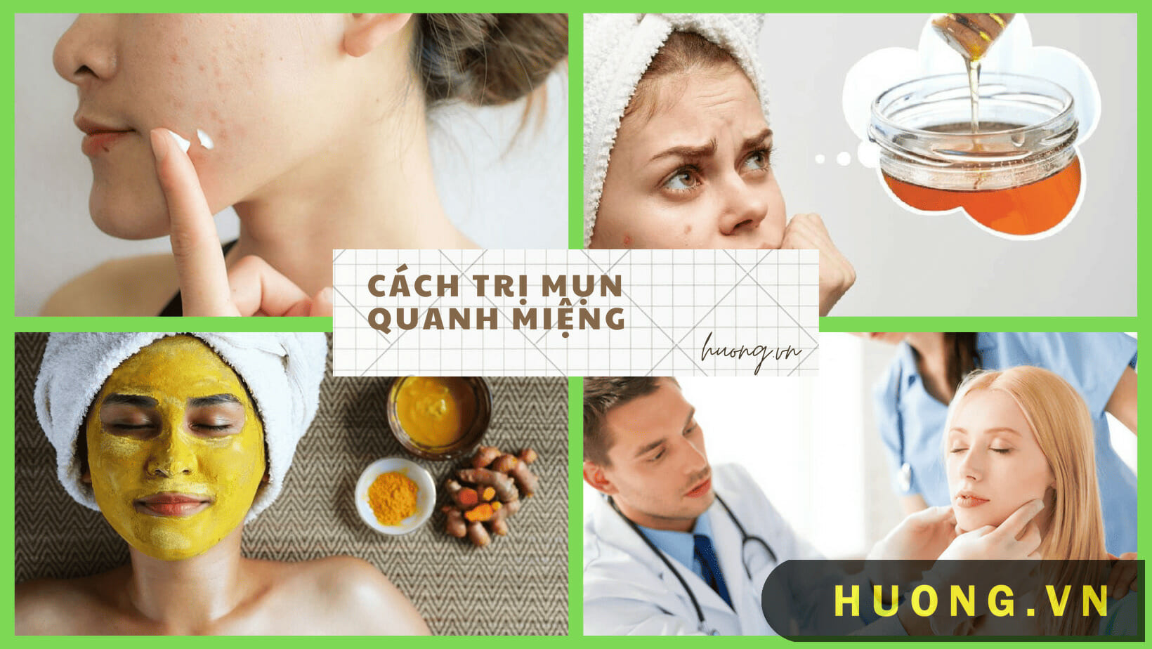 Cách trị mụn quanh miệng