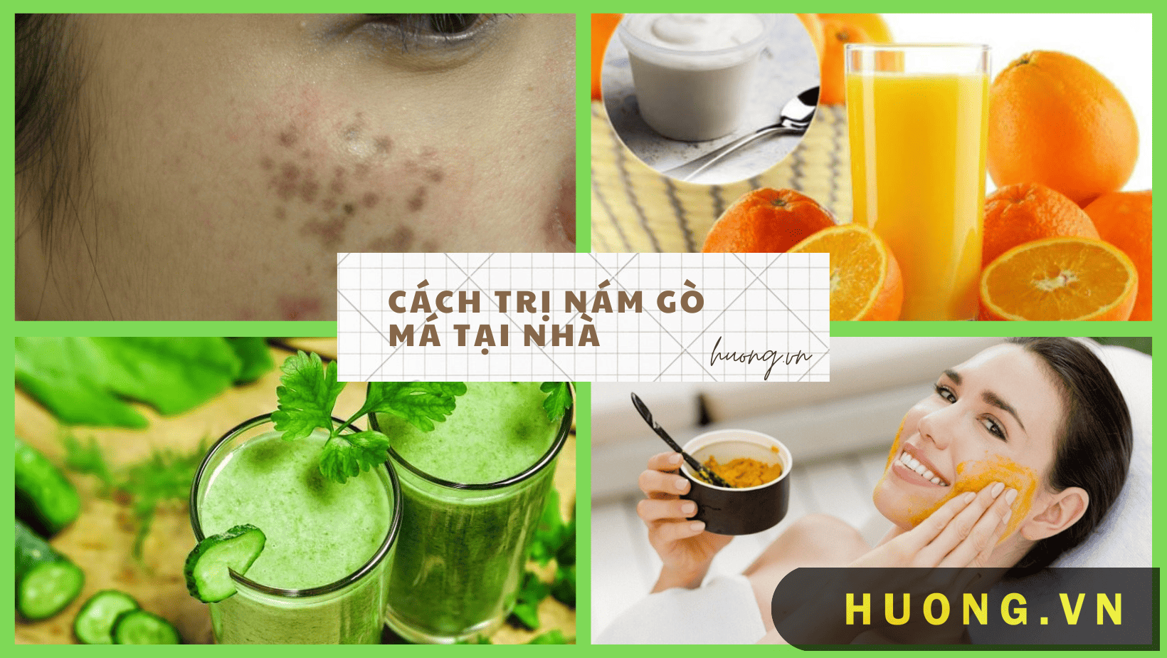 cách trị nám gò má tại nhà