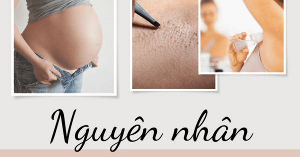 cach tri tham nach trong 3 ngay6 1