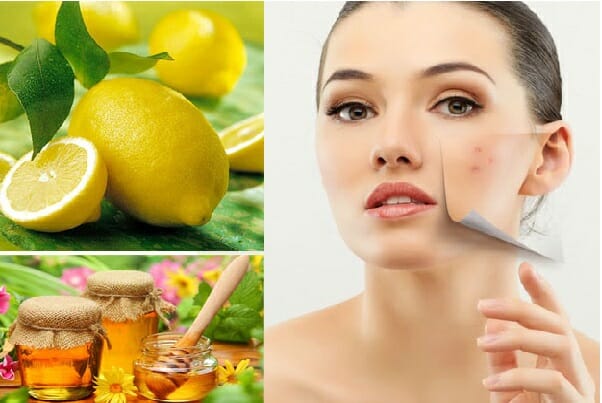 5 cách trị mụn thâm từ nguyên liệu tự nhiên đơn giản, hiệu quả