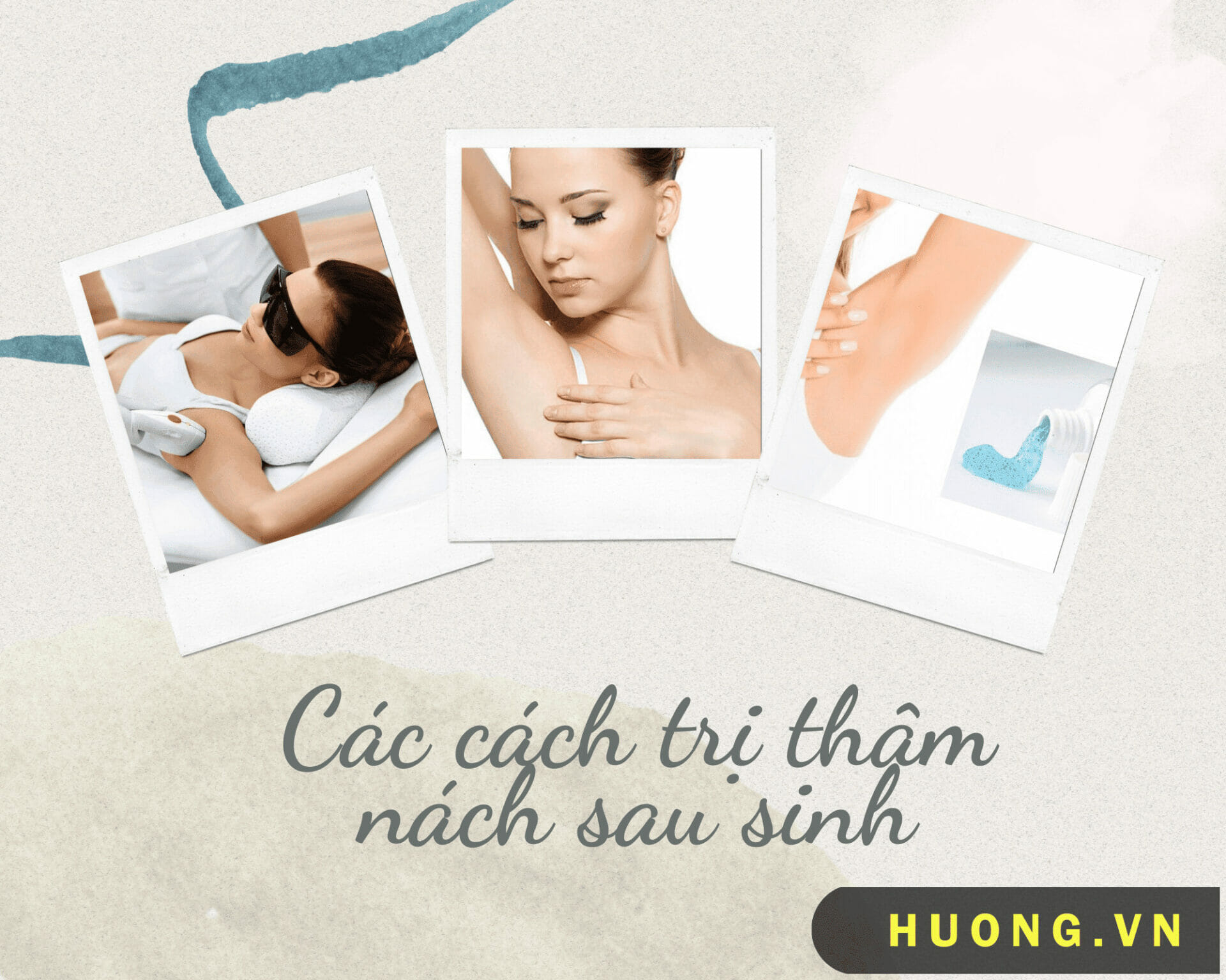 Cách trị thâm nách sau sinh