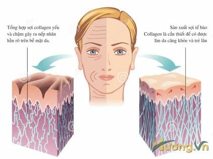 Collagen ảnh hưởng lớn cấu trúc của da