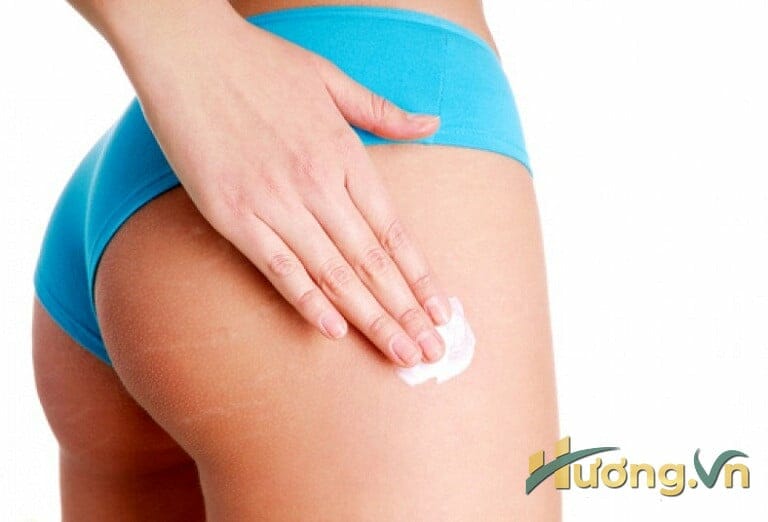 Cách trị rạn da