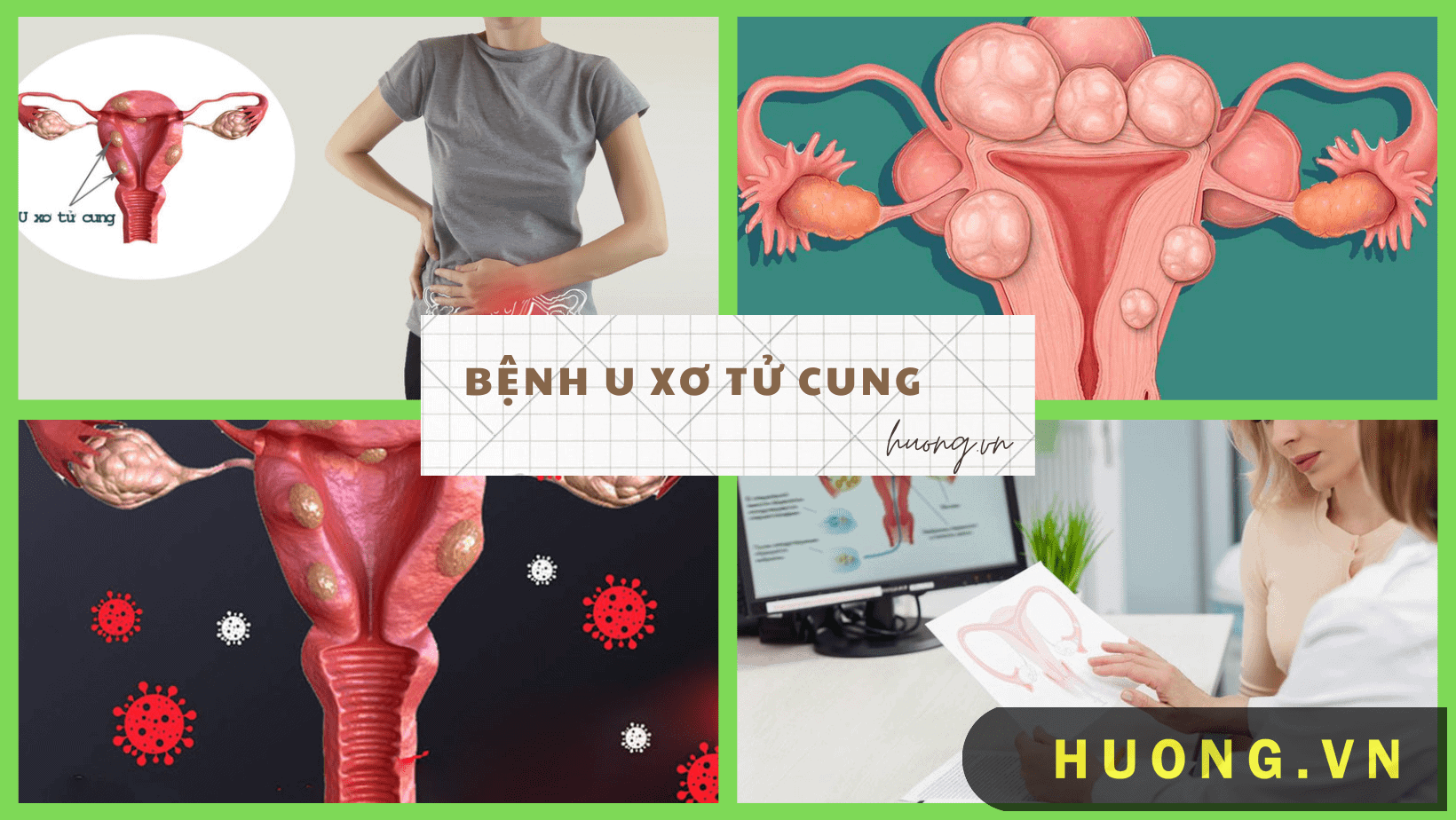 U xơ tử cung có nguy hiểm không