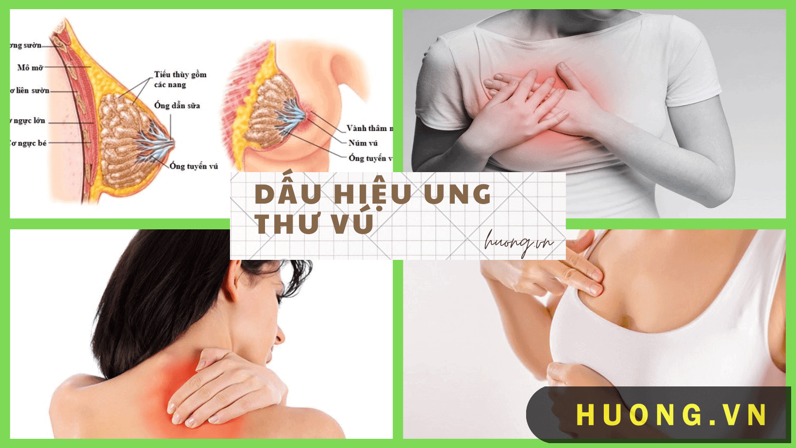 Dấu hiệu ung thư vú giai đoạn đầu