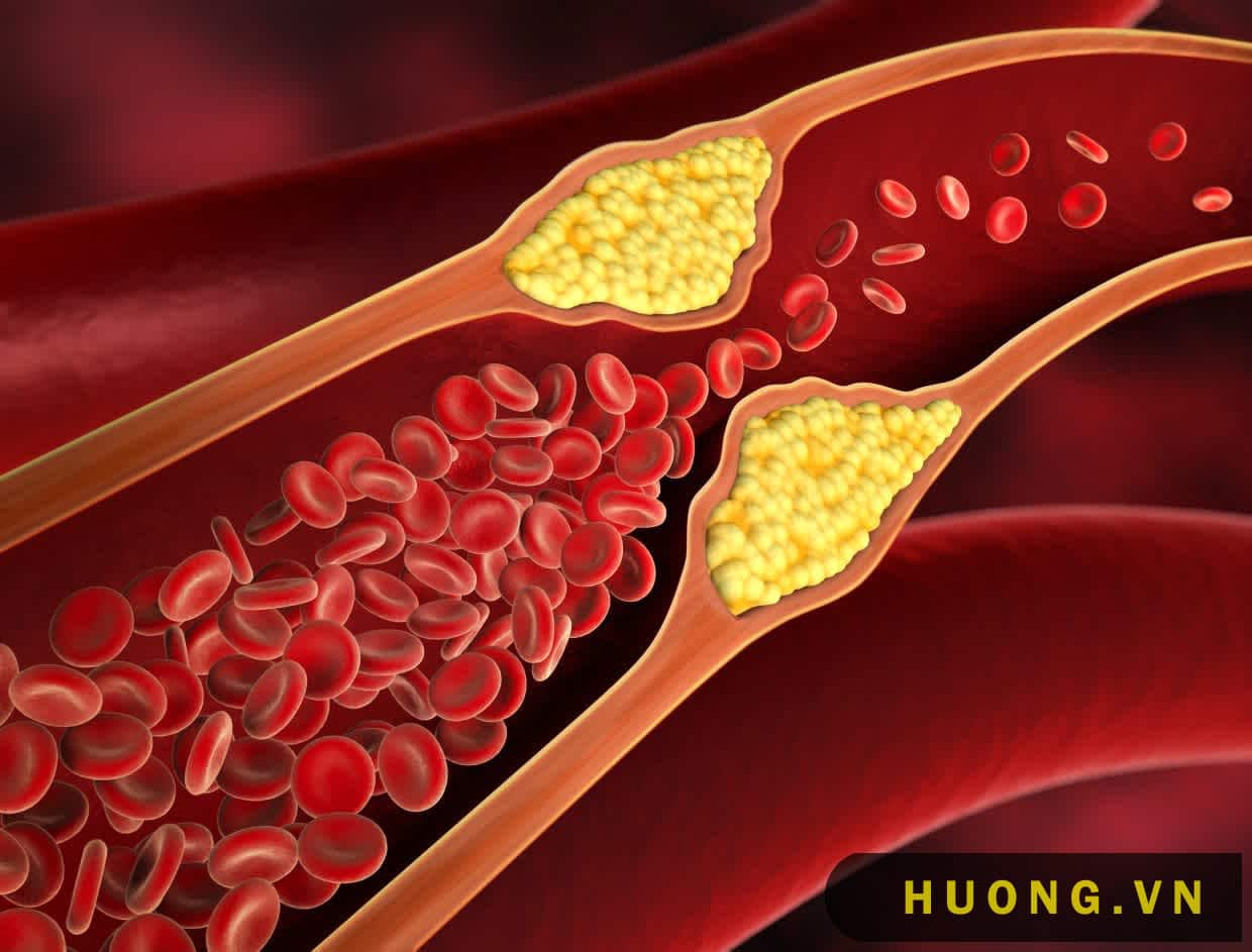 Hình ảnh cholesterol